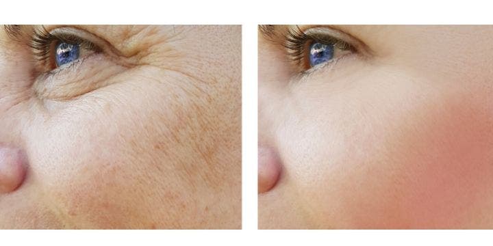comparaison entre peau mature et peau jeune